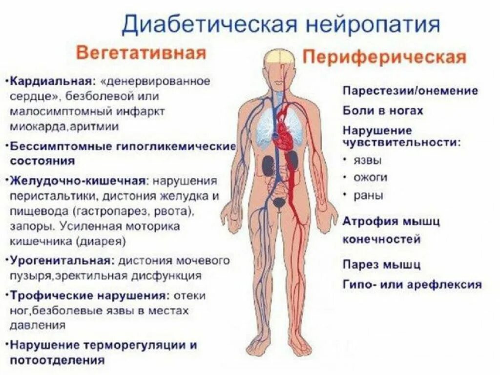 Невропатия нижних конечностей симптомы. Клинические симптомы диабетической нейропатии. Сахарный диабет полинейропатия. Симптомы диабетической периферической нейропатии. Диабетическая периферическая полинейропатия симптомы.