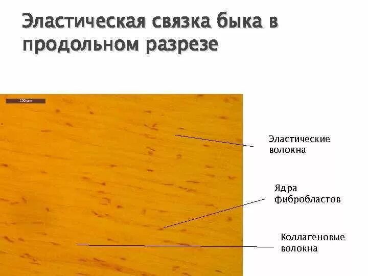 Эластическая связка. Плотная оформленная соединительная ткань выйная связка. эластическая оформленная волокнистая соединительная ткань. плотная оформленная соединительная ткань эластического типа. плотная оформленная соединительная ткань эластическая связка.