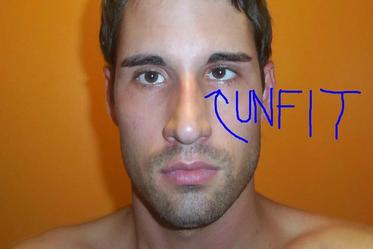 Lazy eye. How to fix lazy eye. lazy eye - soulship. lazy eye американская история. lazy eye meme.