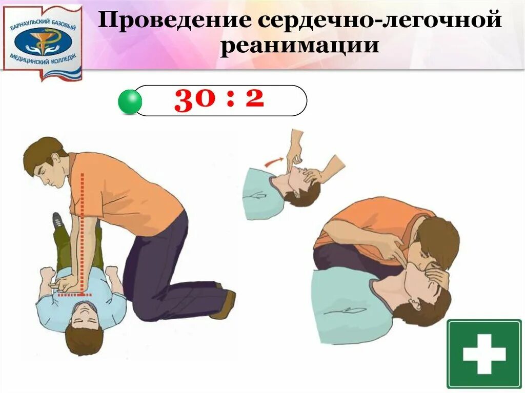 Реанимация 1 помощь. Рисунок проведение сердечно-легочной реанимации. техника оказания сердечно легочной реанимации. середечнолегочная реанимация. сердечно-легочная реанимация (слр).