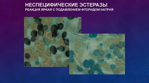 Эстераза