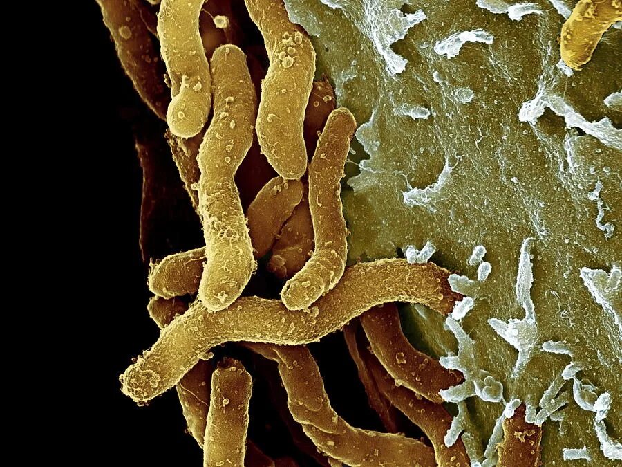 Хеликобактер пилори в микроскопе. Хеликобактер пилори язва. Бактерия хеликобактер пилори под микроскопом. Хеликобактер пилори под микроскопом в желудке.