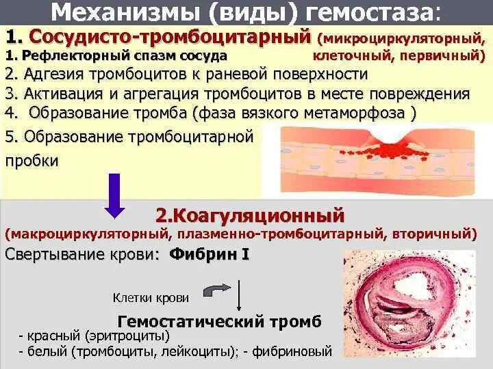 При повреждении сосудов тромбоциты. Сосудисто-тромбоцитарный гемостаз механизм. Схема тромбоцитарного и коагуляционного гемостаза. Первичный гемостаз тромб. Сосудисто-тромбоцитарный гемостаз механизм образования.