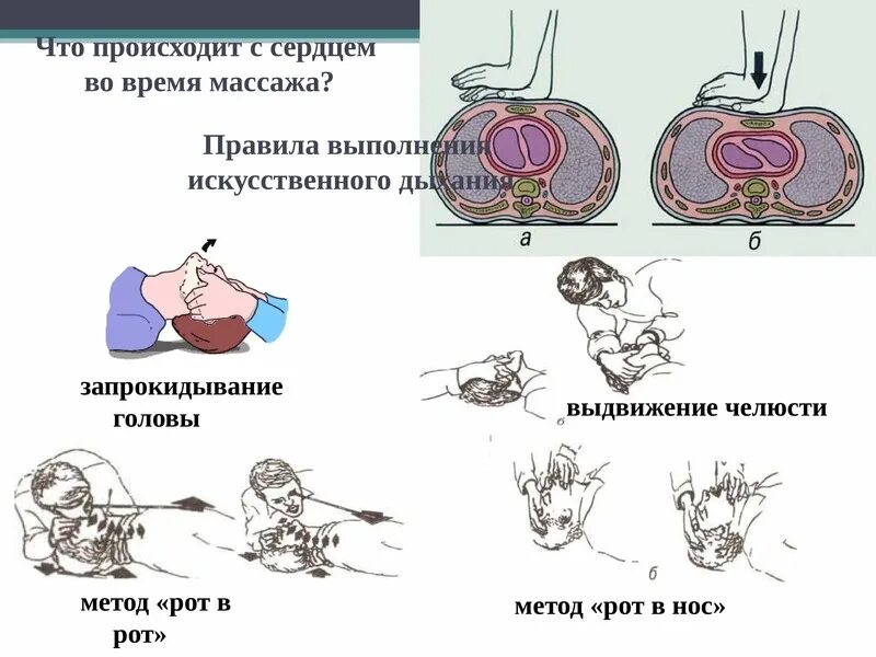 ПМП при внезапной остановке сердца. Оказание первой помощи при остановке сердца кратко. Остановка сердца первая помощь алгоритм. Памятка при остановке сердца. Алгоритмы помощи при остановке сердца