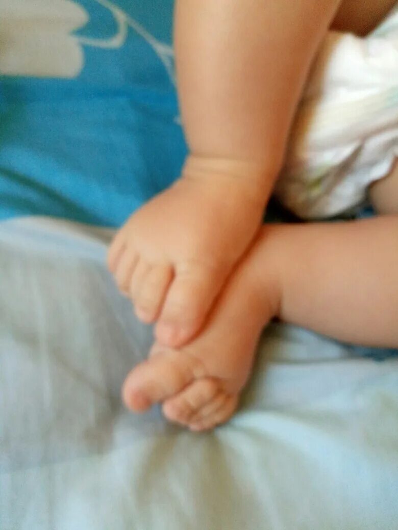 Скрещивания ступней у грудных детей. Ребенок скрещивает ноги 6 месяцев. У новорожденного перекрещены ноги. Ребенок в месяц скрещивает ноги. Скрещенные ноги у младенца.
