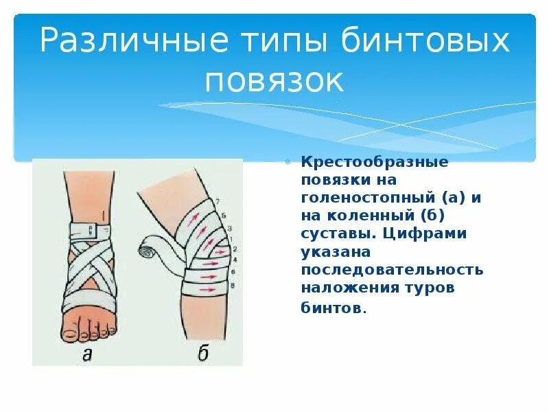 Бинтовая повязка алгоритм. Бинтовые повязки на конечности. Наложение бинтовых повязок. Техника наложения бинтовых повязок.