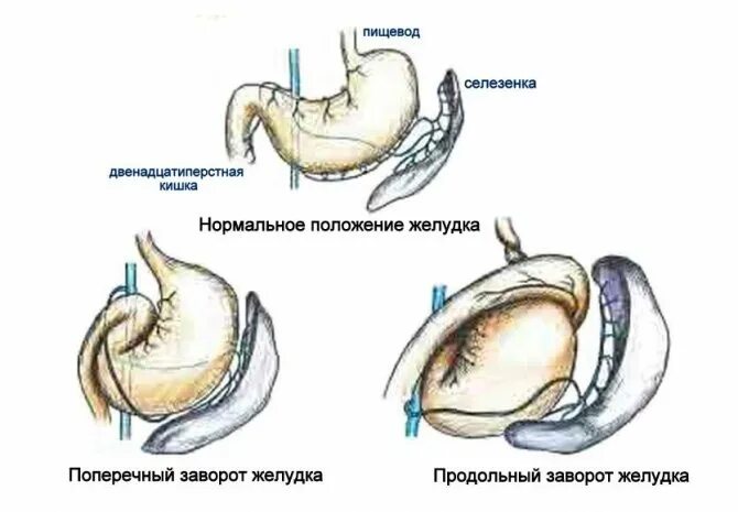 Острое расширение желудка у собак симптомы. Острое расширение желудка у собак. Заворот желудка у собаки операция. Можно собакам селезенку