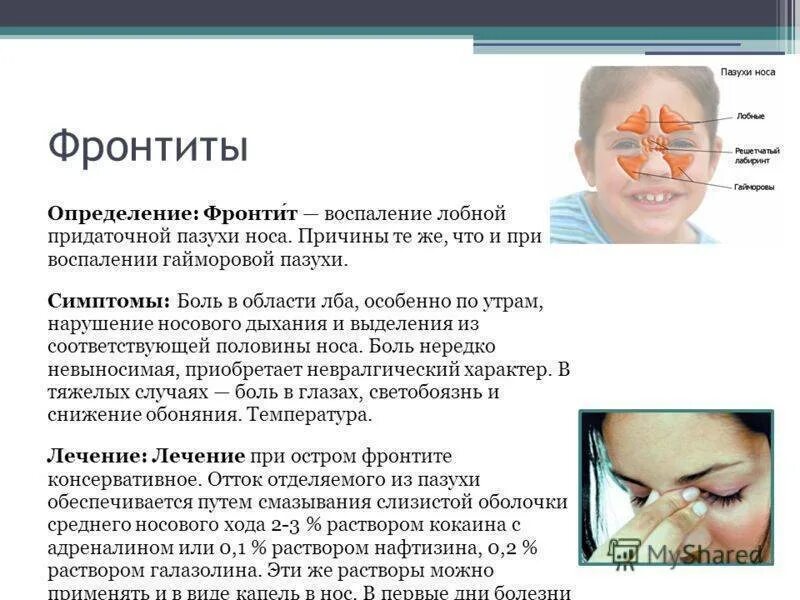 Синусит симптомы и причины что. Острый фронтальный синусит симптомы. признаки воспаления верхнечелюстной пазухи. симптомы острого верхнечелюстного синусита. синусит лобной пазухи симптомы.