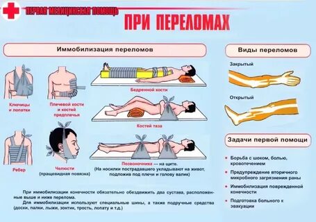 Оказание первой помощи при переломах и кровотечениях