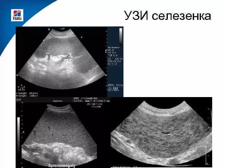 Патологии селезенки узи норма. Узи селезенки собаки. Подкапсульный разрыв селезенки на узи. Лимфома селезенки узи признаки. Узи селезенки норма.