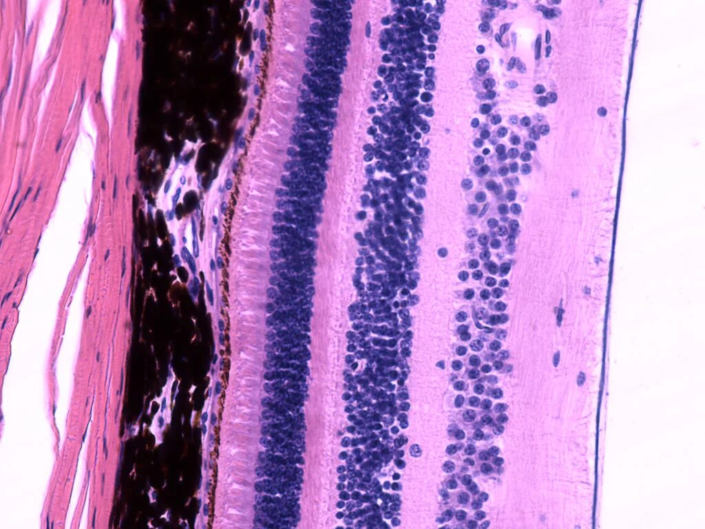 Сетчатая оболочка глаза гистология. Сетчатка гистология препарат. Сетчатка глаза гистология препарат. Роговица препарат гистология.