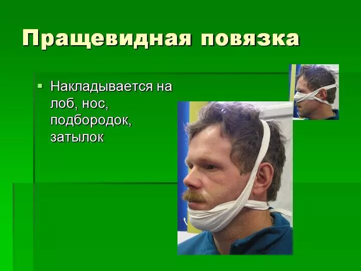 Техника наложения пращевидной повязки