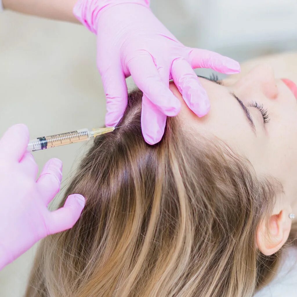 Плазмолифтинг волосистой. Плазмолифтинг волосистой. Плазмолифтинг волосистой. Мезо волосистой части головы. Prp плазмотерапия для волос.