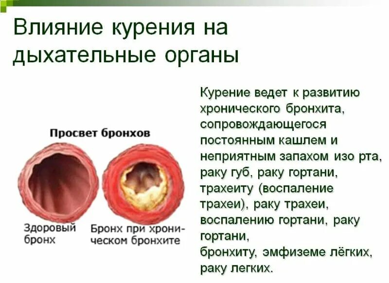 Бронхит нужны для. Курение и дыхательная система. Влияние курения на органы. Воздействия табака на дыхательную систему.