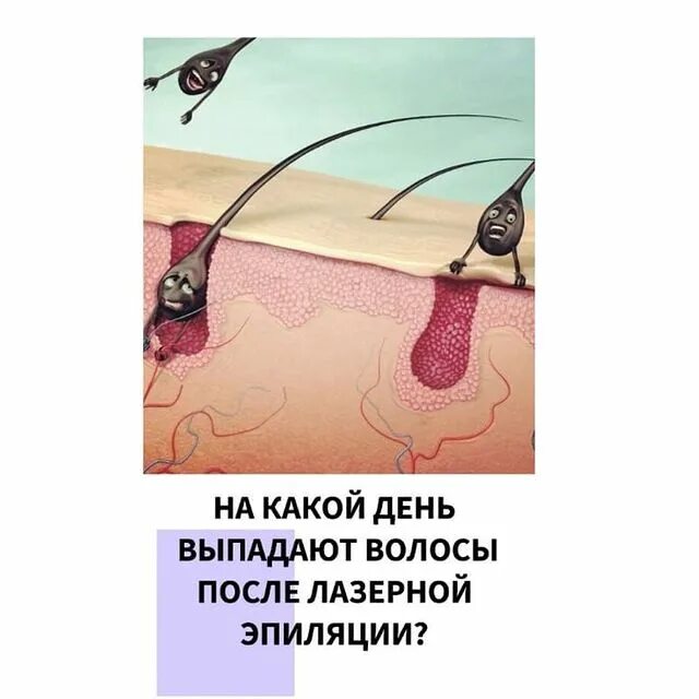 Выпадение волос после лазерной эпиляции. После лазерной эпиляции волосы растут быстрее и больше. После лазерной эпиляции. Когда выпадают волосы после лазерной эпиляции. Когда начнут выпадать волосы после лазерной эпиляции.