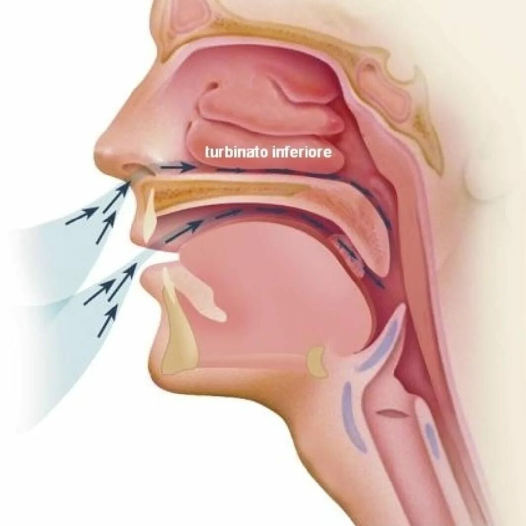 Выходит воздух из носа. Слизистая оболочка носоглотки. Слизистая оболочка верхних дыхательных путей. Слизистые оболочки носоглотки.