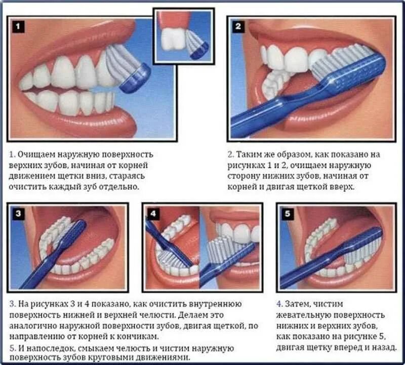 Схема правильной чистки зубов. Методы чистки зубов стандартный метод чистки зубов. Правильная методика чистки зубов зубной щёткой. Памятка о правильной чистке зубов. Можно ли чистить зубы ребенку