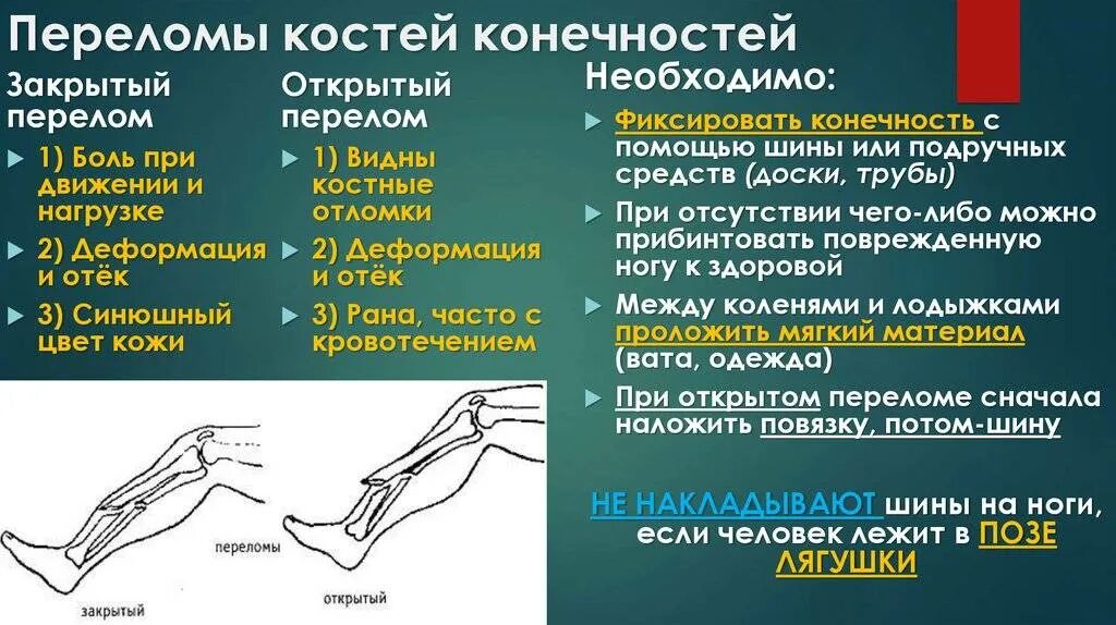 Виды переломов и первая помощь при них. Переломы костей конечностей. Переломы нижних конечностей. Переломы костей нижних конечностей. Открытый перелом и закрытый перелом.