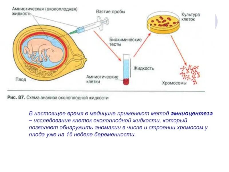 Строение и функции околоплодных вод. Амниотическая жидкость при амниоцентез. Амниотическая жидкость. Функции амниотической жидкости. Исследование околоплодных вод.