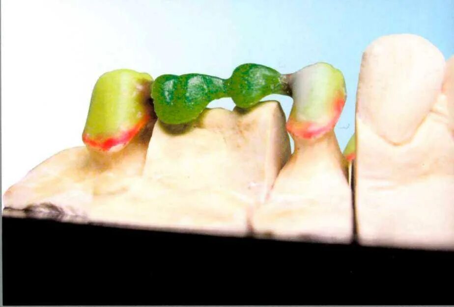 Восковое нет. Химическая структура восков. Восковое нет. Отливка воском значение фигур расшифровка. Восковое нет.