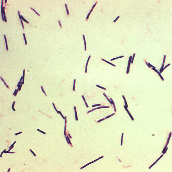 Clostridium spp. Clostridium perfringens по Ожешко.