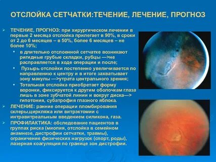 Диагнозы сетчатки