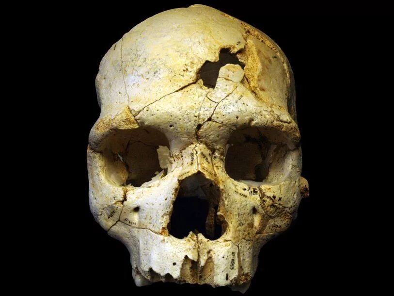 Расколотый человеческий череп. Человеческий череп без нижней челюсти. Ломать череп. Череп без нижней челюсти. Череп без нижней челюсти.