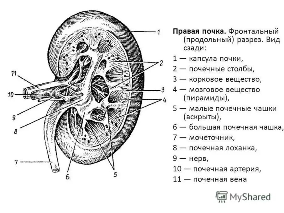 На рисунке 2 изображено строение почки. Схема анатомического строения почки. Строение почки человека рисунок. Внутреннее строение почки схема. Схема Раздольного разреза почки.