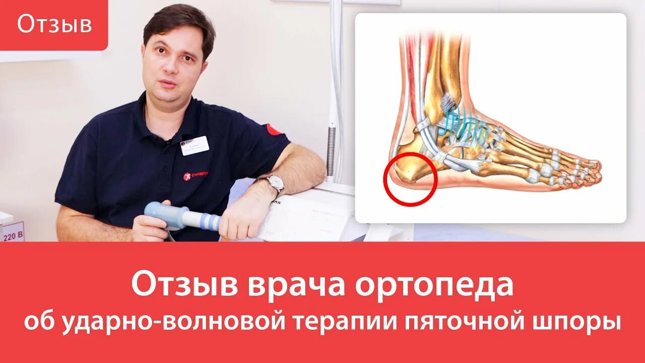 Ортопед ударно волновая. Ударно волновая терапия от пяточной шпоры. Всемирный день врача-травматолога. Лечение пяточной шпоры ударно волновой терапией в Москве.
