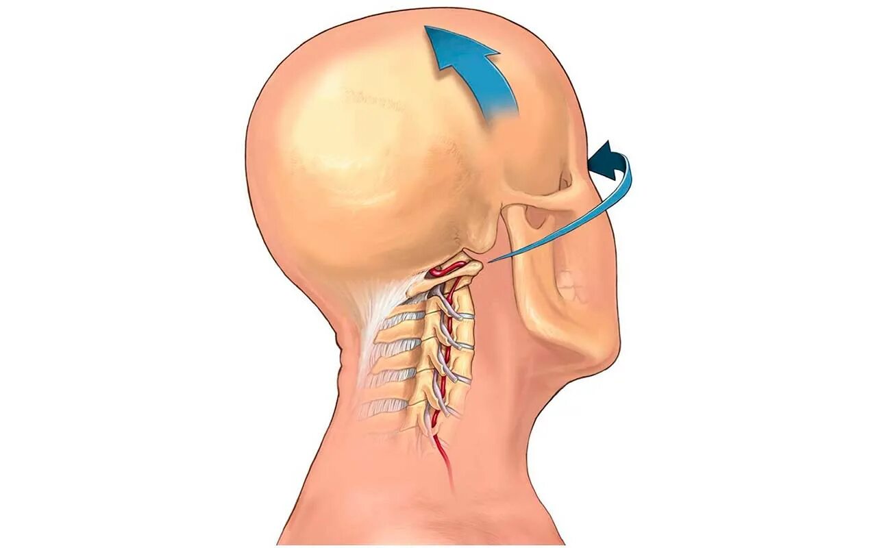 Что делать если больно поворачивать. Шейный остеохондроз. Хрящи шейного отдела позвоночника.