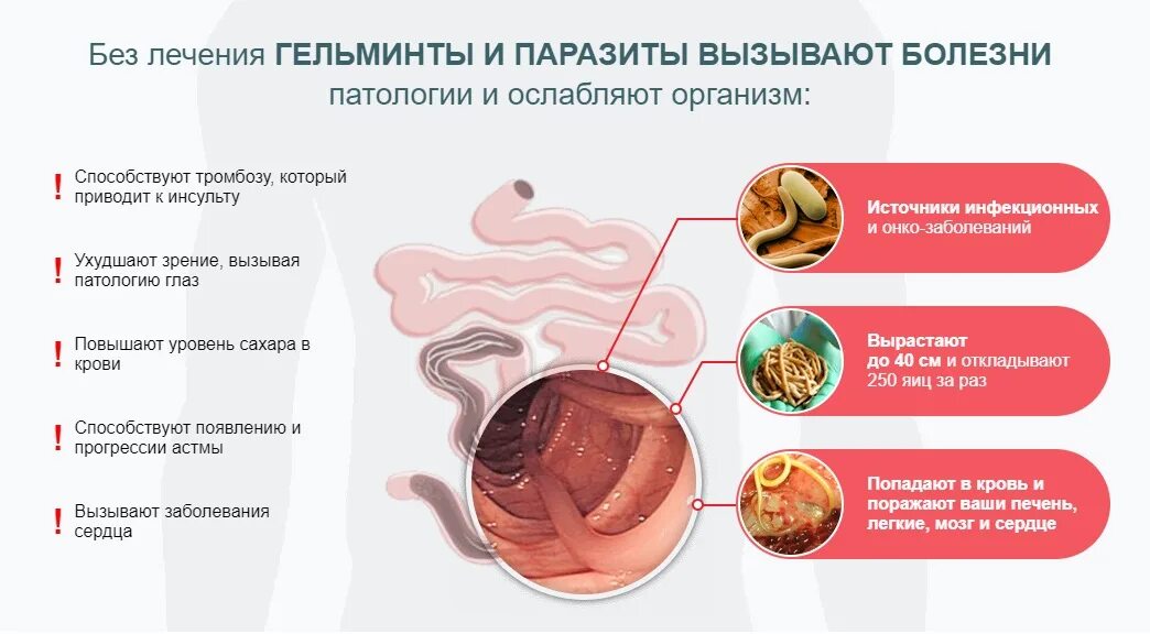 Паразиты как определить