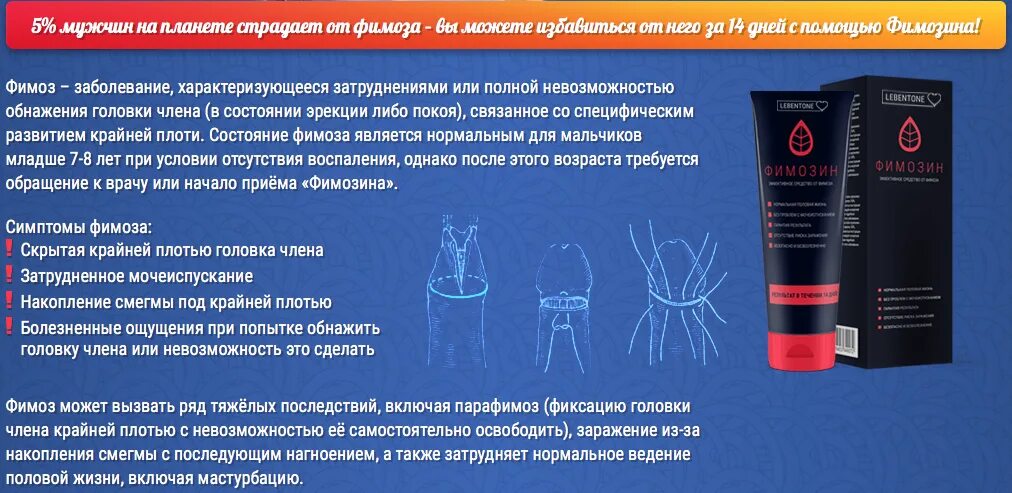 Короткая уздечка полового члена и метод ее коррекции - френулопластика