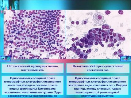 Пролиферация цитология
