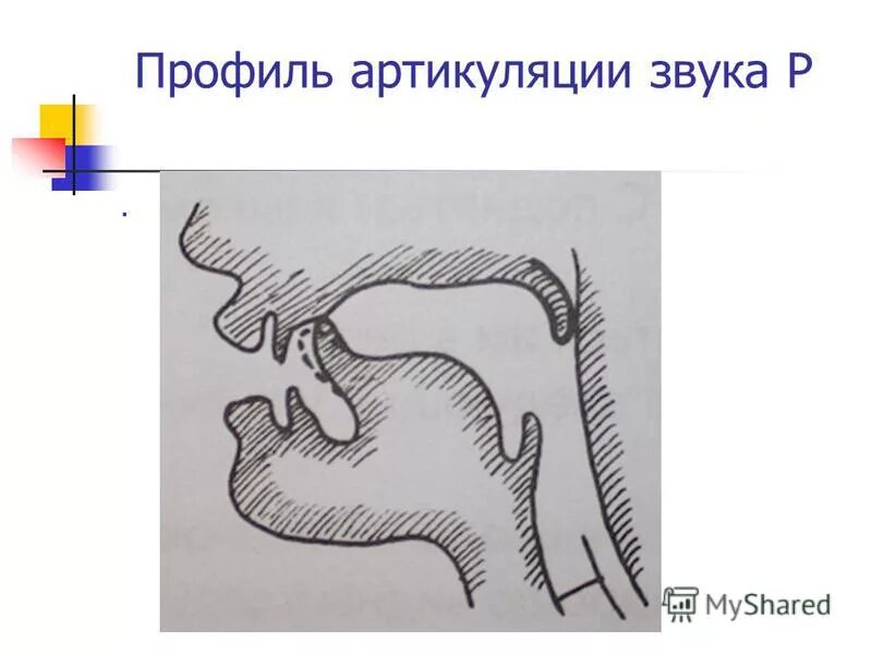 Профили артикуляции звуков. Профиль артикуляции звука р. Профель артикуляц звук р. Логопедический профиль звука р. Артикуляционный профиль р рь.