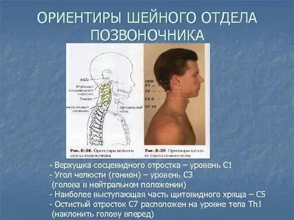 3 и 4 позвонки шейного отдела