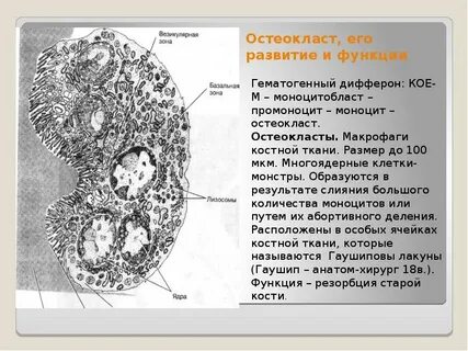 Остеокласты