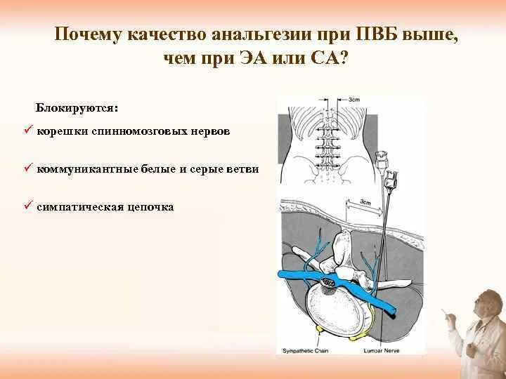 Паравертебральная поясничная блокада. Паравертебральная блокада в акушерстве. Методика паравертебральной блокады. Техника выполнения паравертебральной блокады.