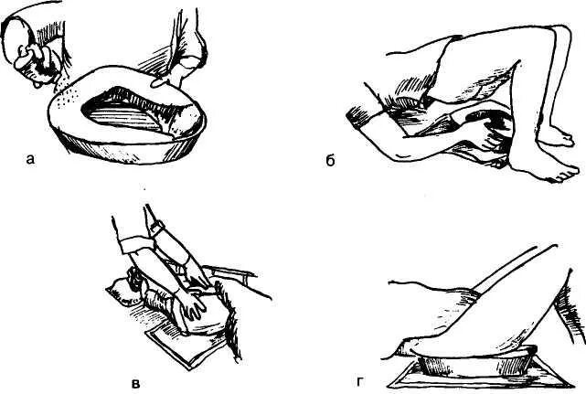 Как правильно пописать. Подмывание лежачего больного алгоритм. Подмывание больных подача судна. Подмывание тяжелобольного пациента алгоритм. Алгоритм подачи судна и мочеприёмника тяжелобольному пациенту.