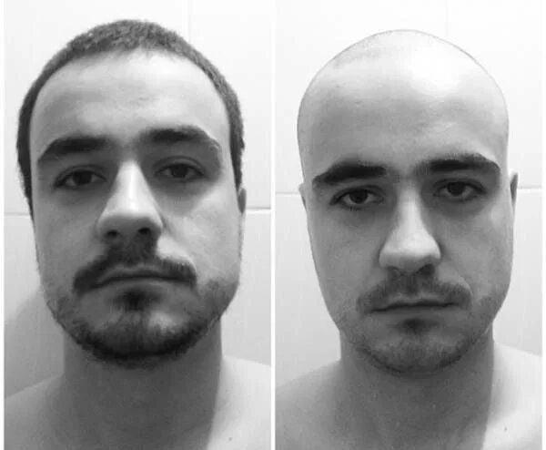 женская стрижка налысо до и после. лысые знаменитости девушки. кристен стюарт налысо. как понять пойдет ли налысо. как понять пойдет ли налысо.