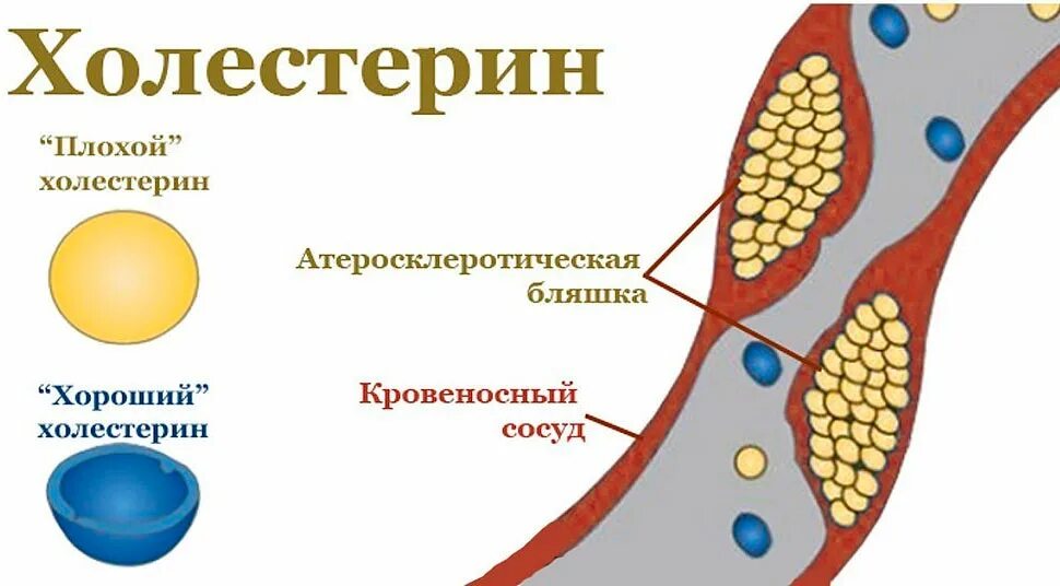 Холестерин г