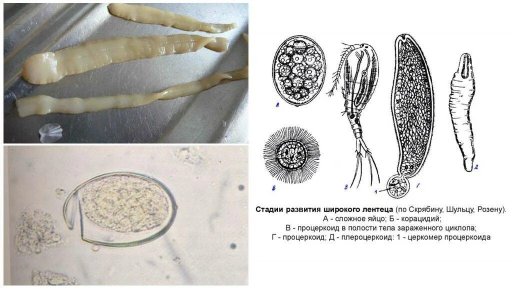 Личинки лентеца. Ленточные черви широкий лентец. Широкий лентец (Diphyllobothrium latum). Широкий лентец инвазионная форма. Широкий лентец процерклид.