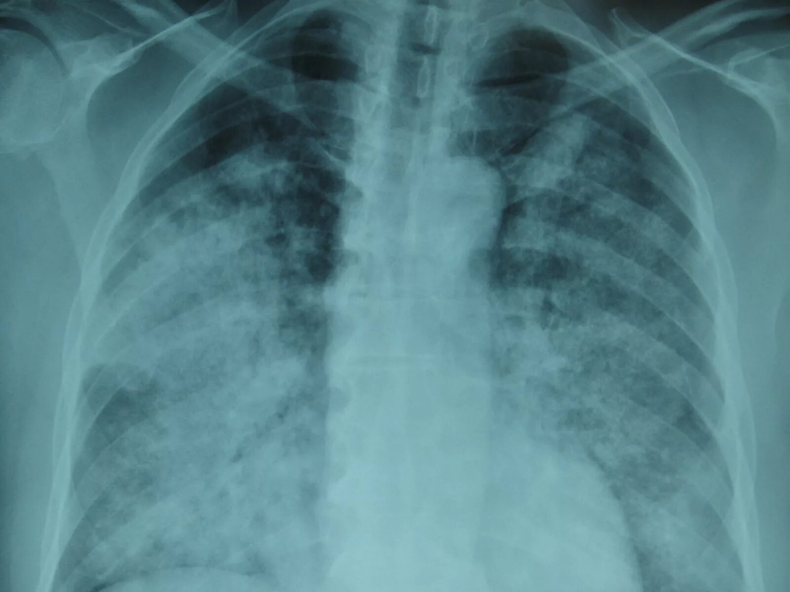 Pin on Terminologie médicale Radiology, Radiology tech, Radiology imaging