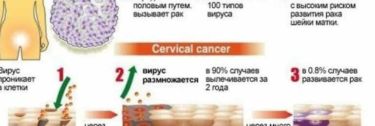 Папиломы вирус передается от человека к человеку. Пути инфицирования ВПЧ. Путь передачи ВПЧ-инфекции.