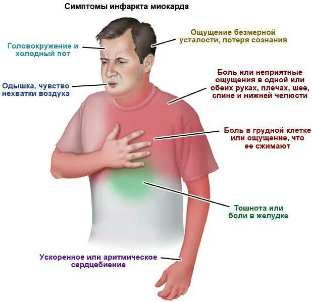 Симптомы заболевания инфаркта миокарда. Ранние симптомы инфаркта миокарда. Болит сердце. Боли в области сердца. Неприятные боли в области сердца