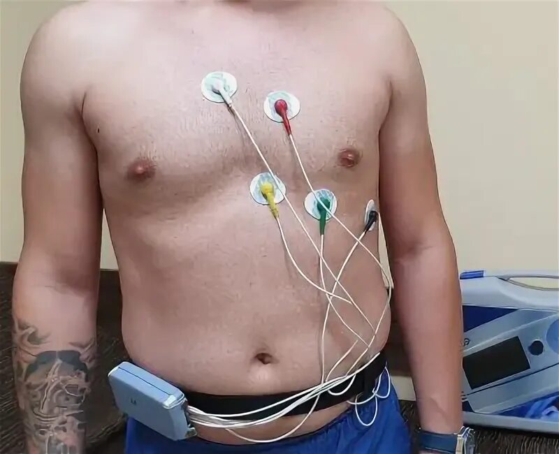 Доктор холтер. Холтер экг holter. Система холтеровского мониторирования экг. Холтер мониторирование 12 канальный. Смад суточный мониторинг артериального.