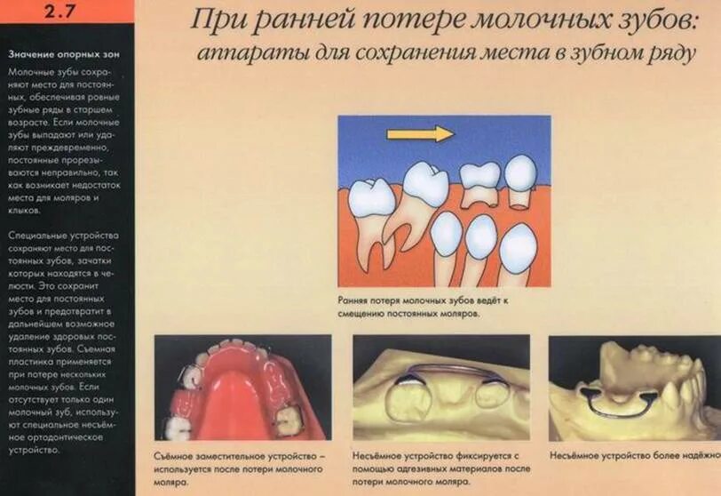 Лечить или удалить молочный зуб. Лечить или удалить молочный зуб