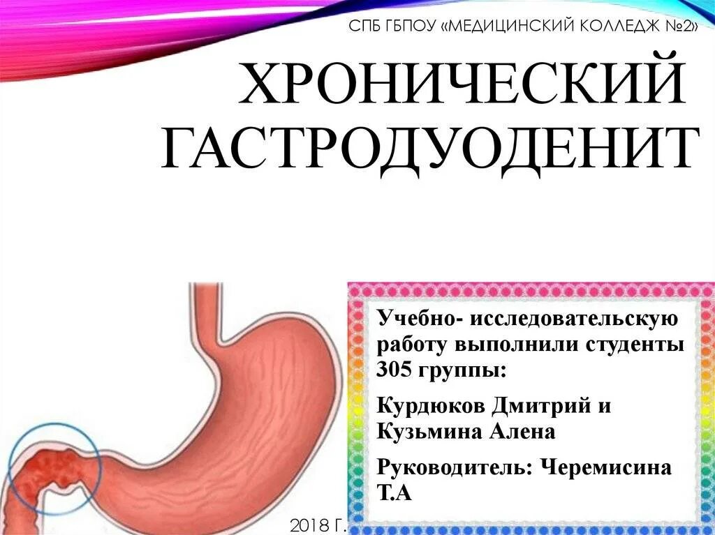 Дуоденит и гастродуоденит. Поверхностный гастродуоденит желудка что это. Гастрит дуоденит гастродуоденит. Хронический гастродуоденит классификация. Гастродуоденит у детей клинические