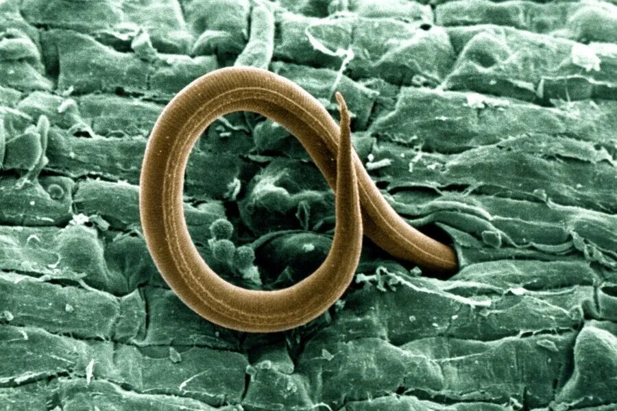 Черви-паразиты нематоды.. Нематоды паразитические черви. Круглые черви нематоды паразиты.