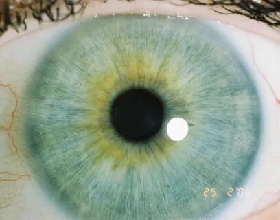 Blue eye twinkle