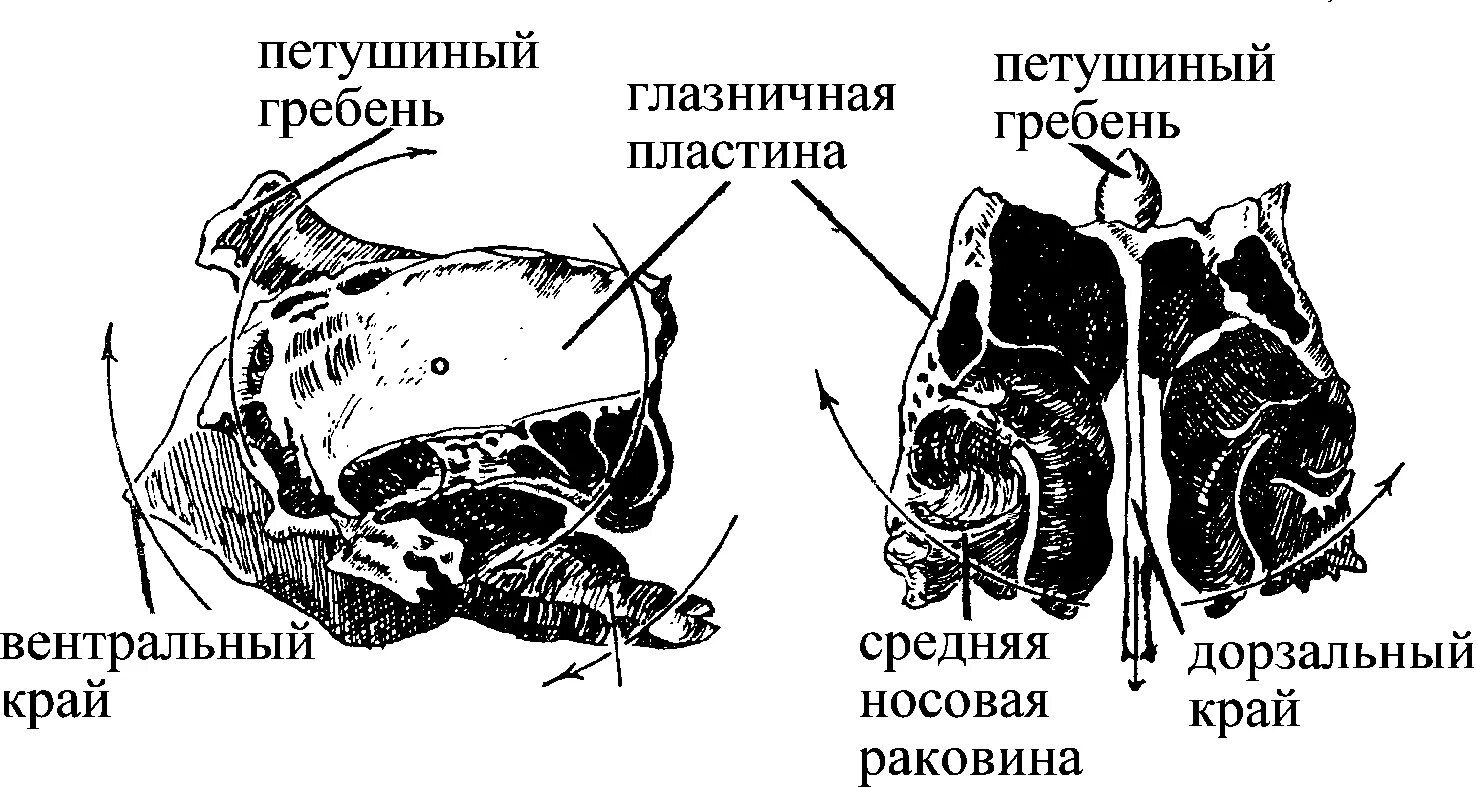 Вентральный гребень. Выйная связка животных. Второй шейный позвонок крупного рогатого скота. Вентральный гребень. Строение грудного позвонка лошади.